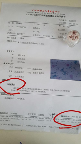 宫颈糜烂是通过什么检查出来的 宫颈糜烂是通过什么检查出来的