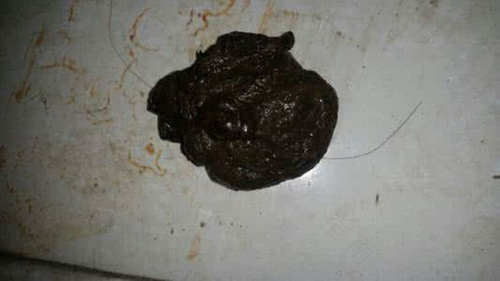 宝宝拉黑色大便是什么原因 宝宝拉黑色大便是什么原因