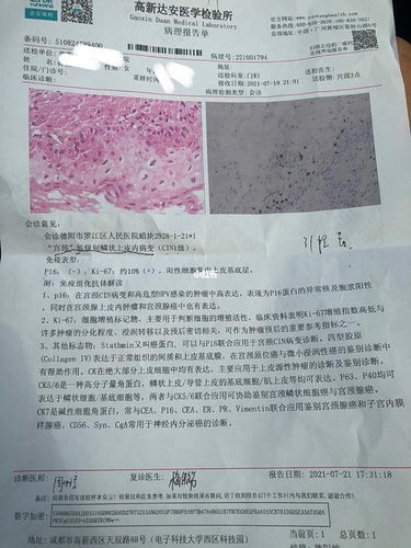 宫颈低度病变怎么治疗彻底 宫颈低度病变怎么治疗彻底