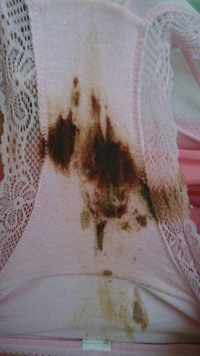 为什么一个月没有来月经突然流水 为什么一个月没有来月经突然流水