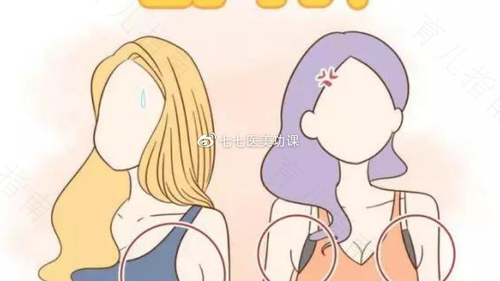 副乳很大怎么办 副乳很大怎么办