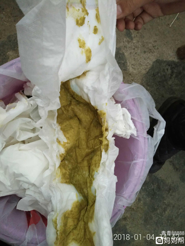 宝宝一天吐了好几次怎么回事 宝宝一天吐了好几次怎么回事