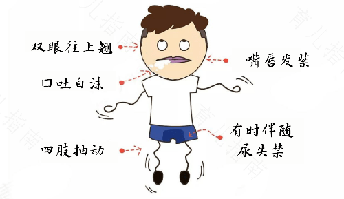 羊癫疯是怎么回事? 羊癫疯是怎么回事?