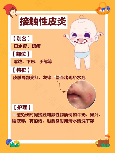 湿疹是不是热出来的吗 湿疹是不是热出来的吗