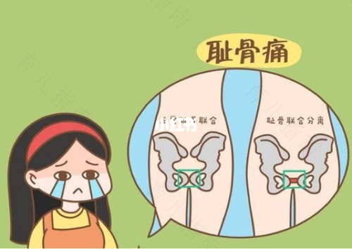 孕中期耻骨痛怎么缓解 孕中期耻骨痛怎么缓解