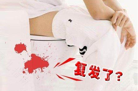 内痔疮出血如何治疗