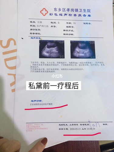 子宫囊肿会引起腰疼吗 子宫囊肿会引起腰疼吗