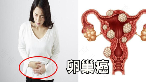 妇科肿瘤严重吗