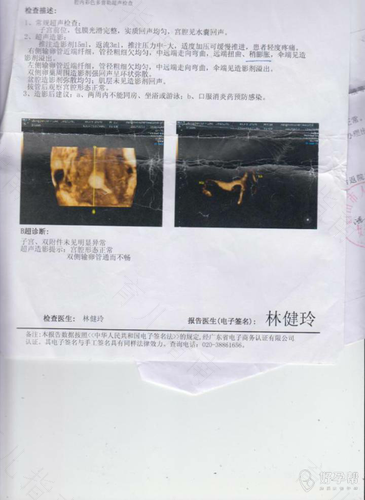 盆腔炎和输卵管炎怎么治疗