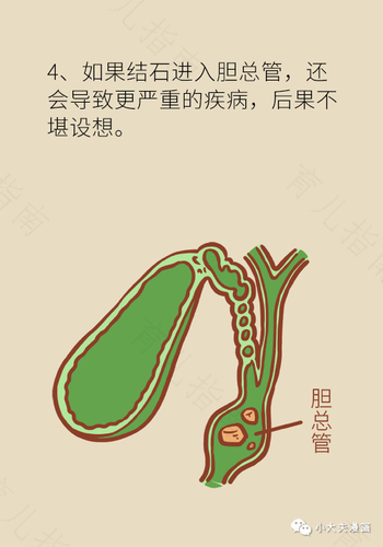 胆囊淤堵怎么办