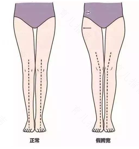 骨盆就是胯骨吗