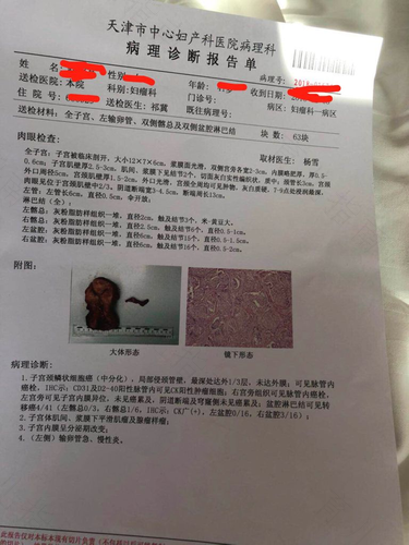 宫颈病理检查是什么意思