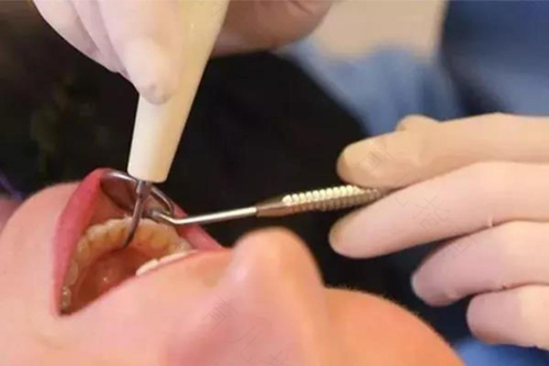 拔牙后疼痛怎么缓解按摩 拔牙后疼痛怎么缓解按摩