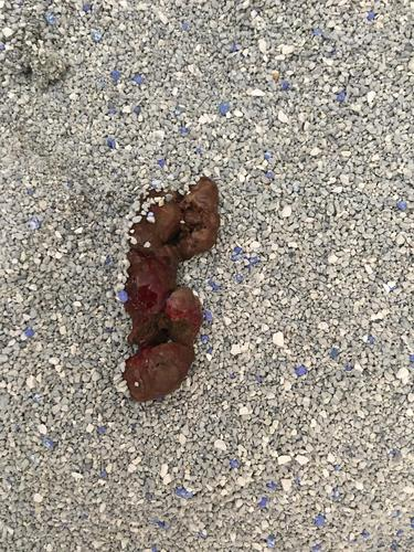 大便里面有血是什么情况,严重吗 大便里面有血是什么情况,严重吗