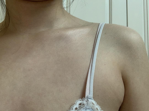 乳头一大一小是怎么回事 乳头一大一小是怎么回事