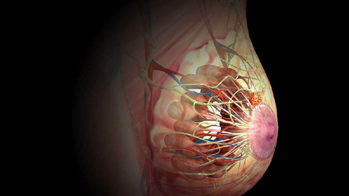 游泳可以缓解乳腺结节吗 游泳可以缓解乳腺结节吗