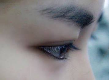 流鼻涕眼睛疼什么原因浑身热 流鼻涕眼睛疼什么原因浑身热