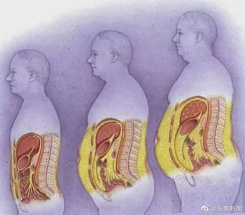 内脏脂肪偏高怎么办 内脏脂肪偏高怎么办