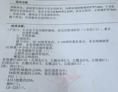 子宫内膜样腺癌2级会转移吗 子宫内膜样腺癌2级会转移吗