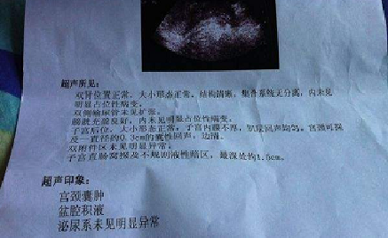 宫颈囊肿有什么症状表现有哪些 宫颈囊肿有什么症状表现有哪些