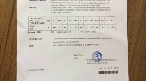 八周验血测不到y就是女孩吗 八周验血测不到y就是女孩吗