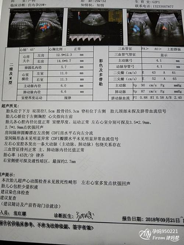 做心脏彩超注意事项 做心脏彩超注意事项