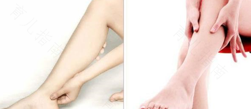 小腿抽筋以后特别疼怎么办 小腿抽筋以后特别疼怎么办