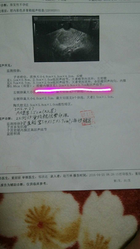 宫腔内息肉影响怀孕吗好大夫 宫腔内息肉影响怀孕吗好大夫