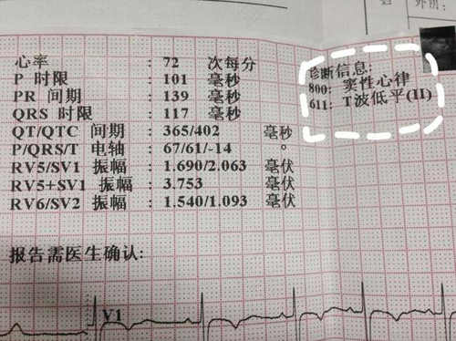 没有窦性心律怎么办 没有窦性心律怎么办