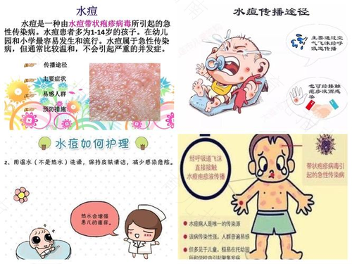 风疹是什么样的图片 风疹是什么样的图片