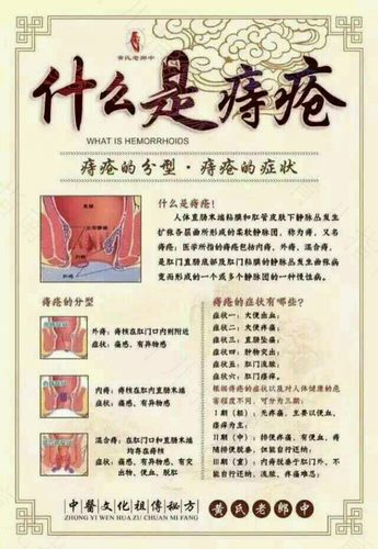 得痔疮很严重吗 得痔疮很严重吗