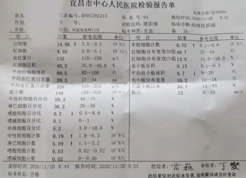 尿常规上皮细胞正常值是多少 尿常规上皮细胞正常值是多少