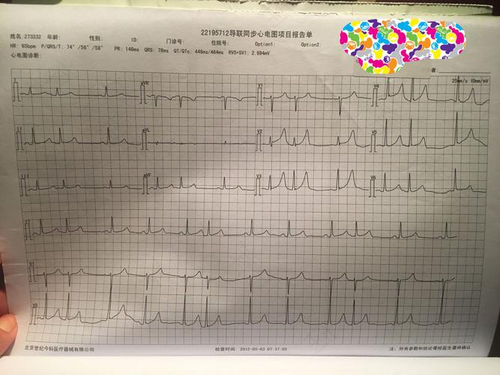 窦性心律失常怎么治 窦性心律失常怎么治