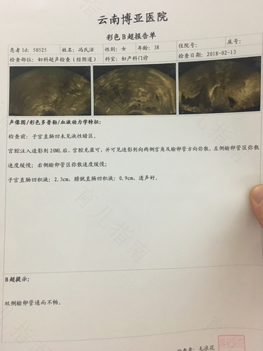 子宫好不好怎么检查 子宫好不好怎么检查