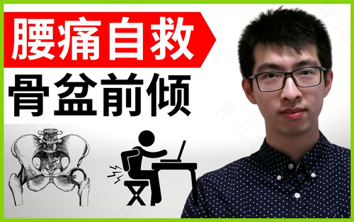 骨盆前倾腰疼怎么办 骨盆前倾腰疼怎么办