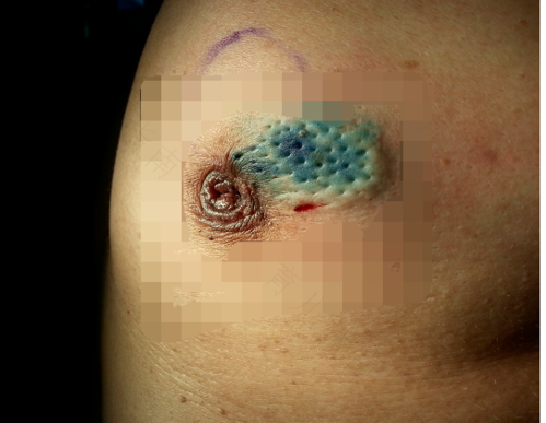 乳房旁边一颗颗的是什么 乳房旁边一颗颗的是什么