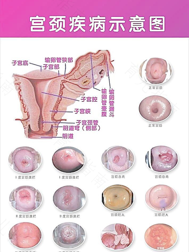 得了妇科炎症该怎么办 得了妇科炎症该怎么办