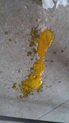 闹肚子总是拉水怎么办 闹肚子总是拉水怎么办