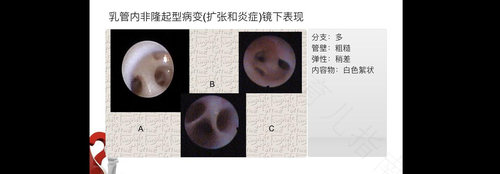 乳头流血了怎么回事 乳头流血了怎么回事