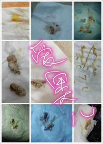 宫颈糜烂老是反反复复怎么办 宫颈糜烂老是反反复复怎么办