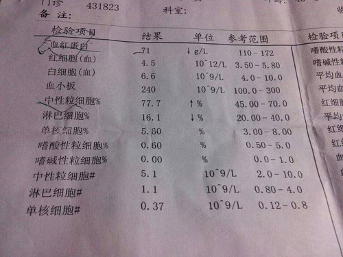 贫血看哪一项数值 贫血看哪一项数值