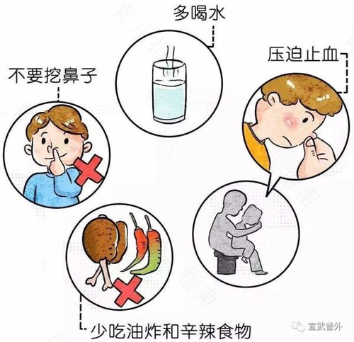 流鼻血了该怎么办止血