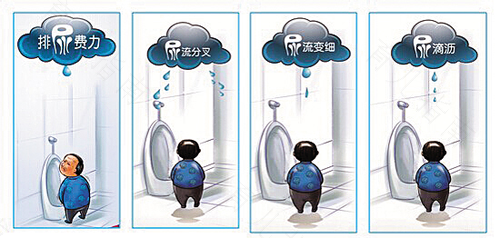 尿急怎么治疗 尿急怎么治疗