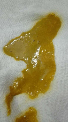 小孩老是拉稀是怎么回事 小孩老是拉稀是怎么回事