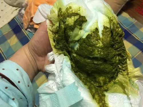 成人大便是绿色是怎么回事