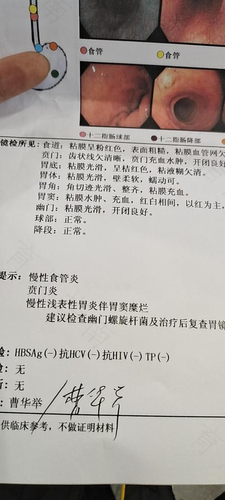 肠镜和胃镜哪个更难受? 肠镜和胃镜哪个更难受?