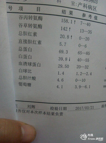 肝功能有点偏高怎么办 肝功能有点偏高怎么办