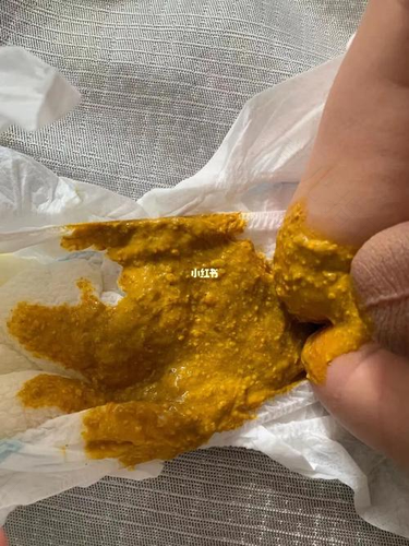 大便很黄是怎么回事 大便很黄是怎么回事