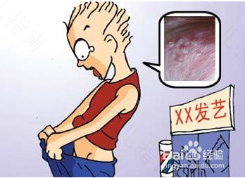 尖锐疣湿是什么原因引起的