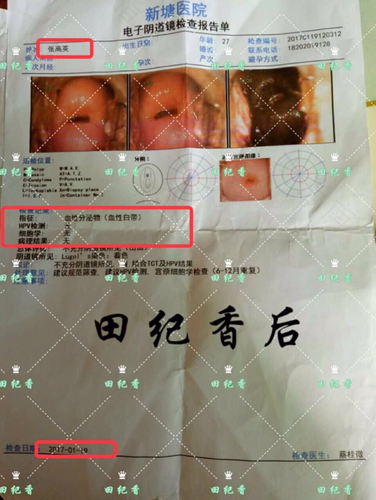 宫颈很光滑是什么意思 宫颈很光滑是什么意思